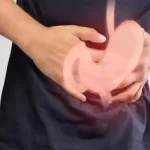 Gastrocolic Reflex